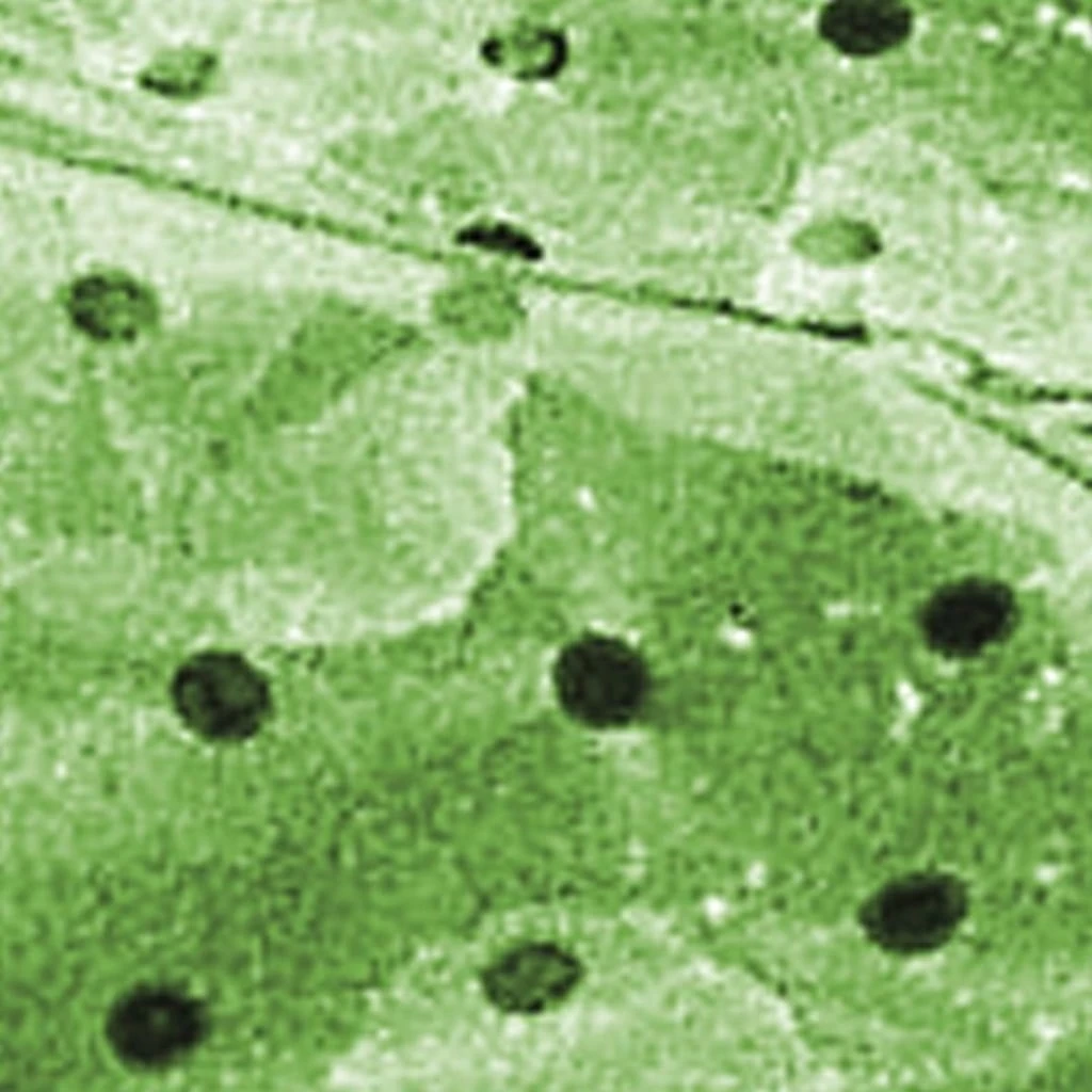 Windhager Folien-Tunnel Komplett Set – Bild 2